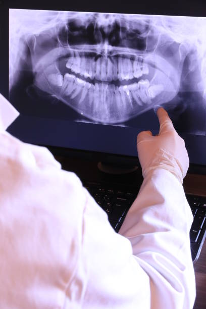 Best Emergency Broken Tooth Repair in Refugio, TX